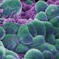 cellula cancro 600x300 scaled cropp