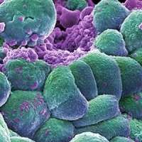 cancer.cells .pic .wellcome.trust .188858703.194754