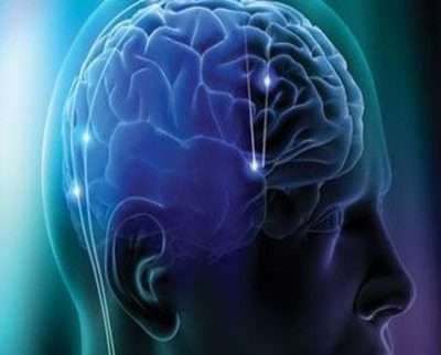 insula cerebrale